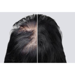 Carin Botea Active Shampoo 5.0 Szampon Przeciw Wypadaniu Włosów 250ml