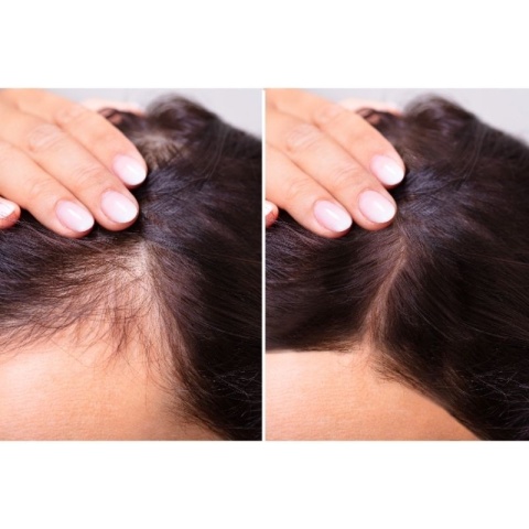 Carin Botea Tonic 6.0 Szampon na Porost Włosów 250ml + Tonic 6.4 Serum do Włosów 6x10ml